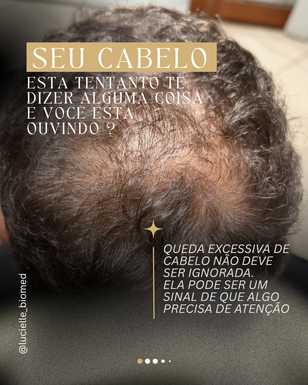 Avaliação do couro cabeludo em caso de queda excessiva de cabelo