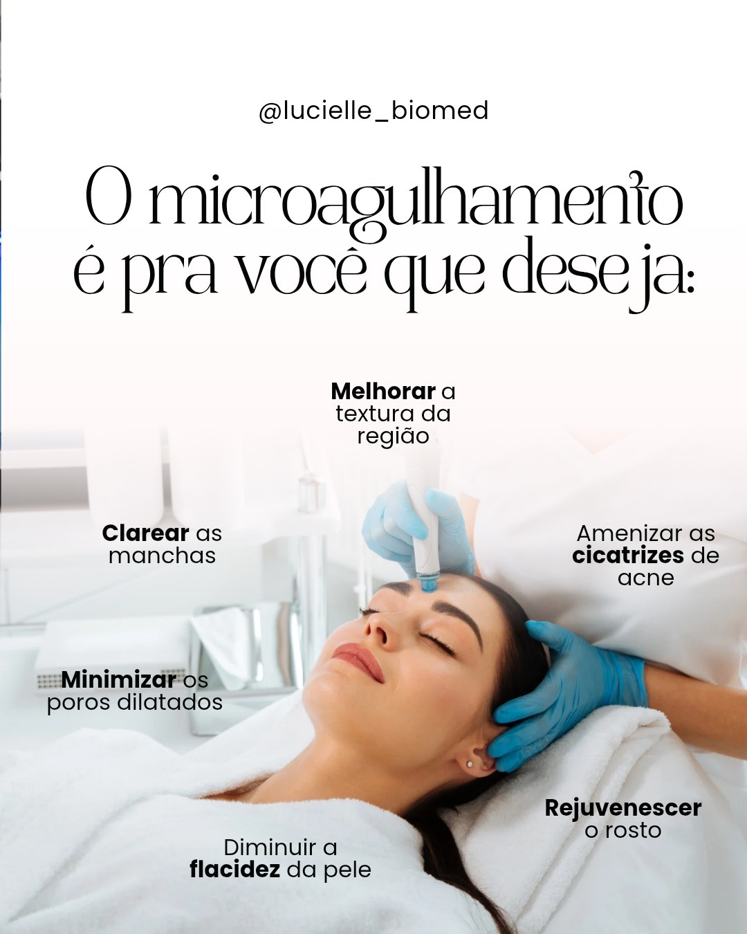 Sessão de microagulhamento facial em atendimento na clínica